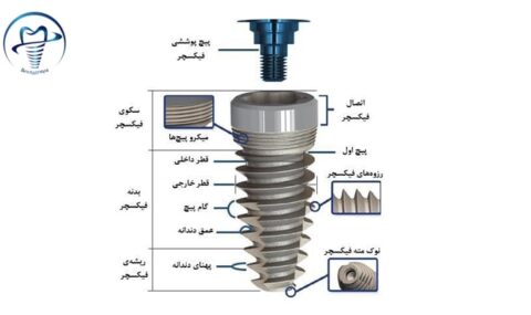 اجزای فیکسچر و انواع آن