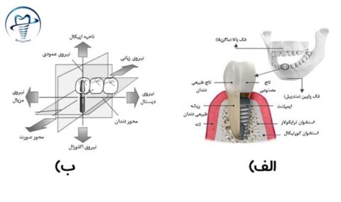 شناسایی تیپ های مختلف استخوان