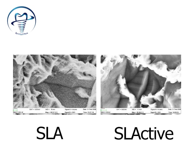 آماده سازی سطح ایمپلنت به روش SLActive